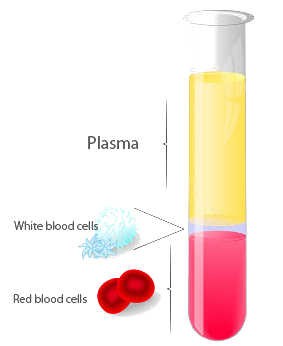 PRP Therapy Treatment Dubai